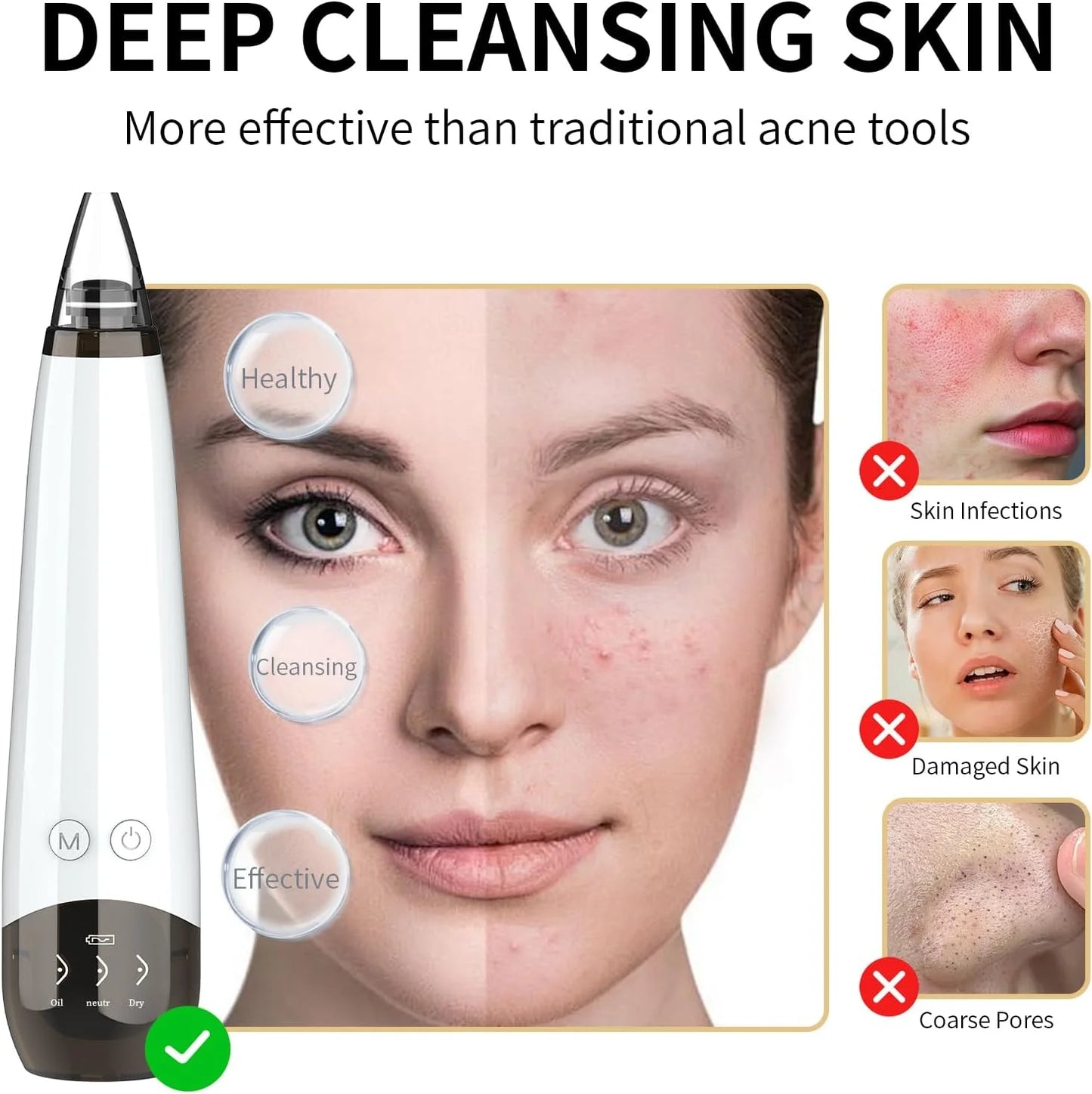 Blackhead Remover Pore Vacuum Cleaner Pimple Extractor - Facial Pore Cleaner Pore Extractor - Electric USB Pore Vacuum with 5 Probes - Blackhead Suction Tool - Blackhead Remover Kit (White)