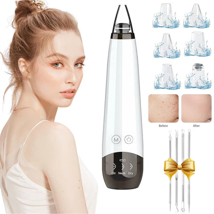 Blackhead Remover Pore Vacuum Cleaner Pimple Extractor - Facial Pore Cleaner Pore Extractor - Electric USB Pore Vacuum with 5 Probes - Blackhead Suction Tool - Blackhead Remover Kit (White)